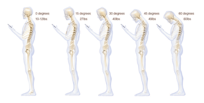 smartphone neck strain